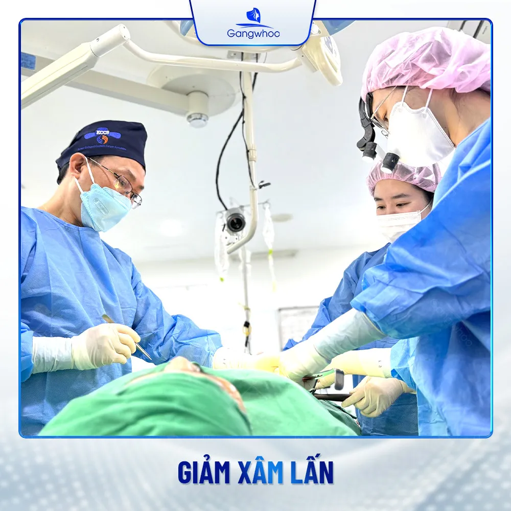 Căng Da Trán SMAS – Trẻ Hóa Làn Da Lấy Lại Thanh Xuân