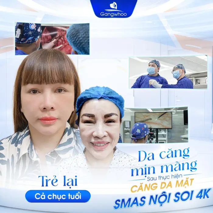 Căng da mặt nội soi ở đâu tốt? Gợi ý 5 địa chỉ uy tín