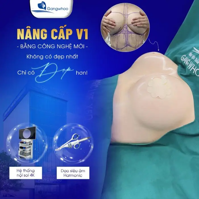 Phương pháp nâng ngực giúp cải thiện vòng 1