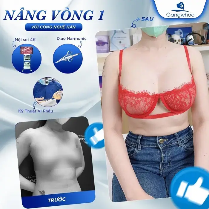 Túi ngực cao cấp, bảo hành lâu dài