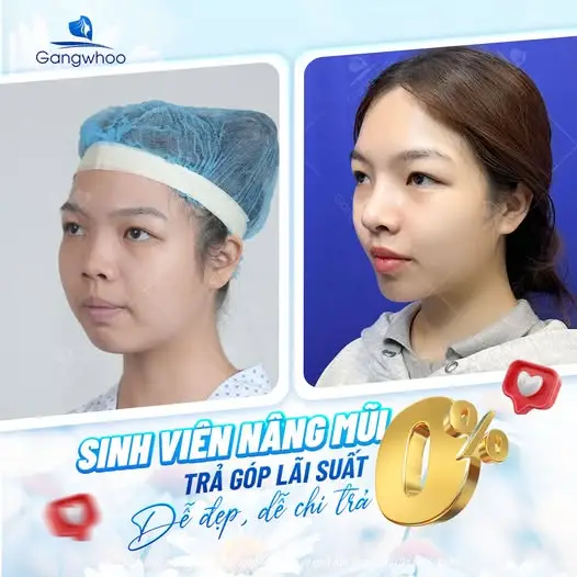 Độ tuổi có quan trọng khi nâng mũi