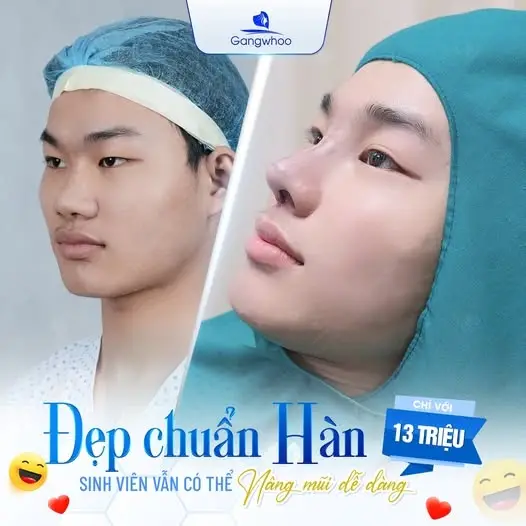 Dáng mũi Hàn Quốc