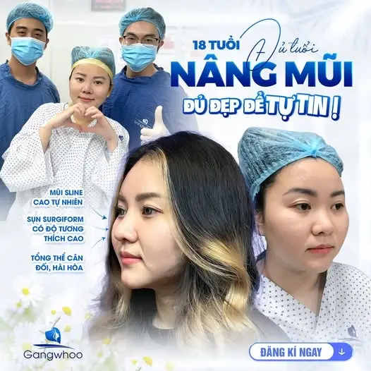 Nâng mũi bằng sụn nhân tạo