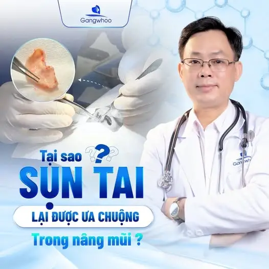 Nâng mũi bọc sụn tự thân
