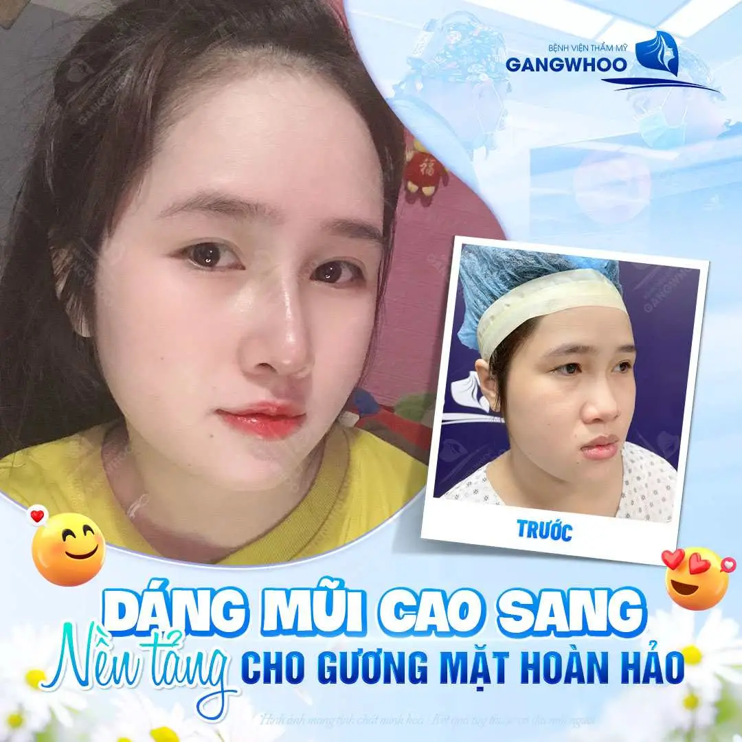 Có được uống collagen sau khi nâng mũi?