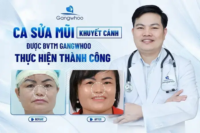 Khi xuất hiện các tình trạng biến chứng nguy hiểm như mũi bị viêm, có mũ hãy đến các bệnh viện uy tín để xử lý