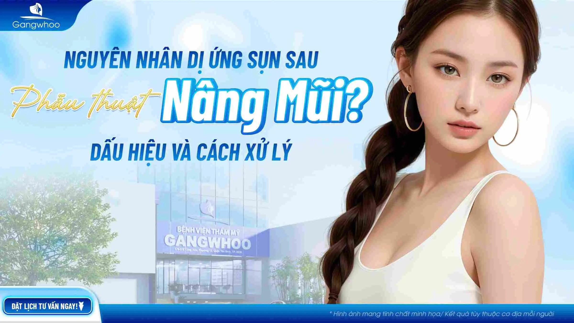 Nguyên Nhân Dị Ứng Sụn Sau Nâng Mũi? Dấu Hiệu Nhận biết Và Cách Xử Lý