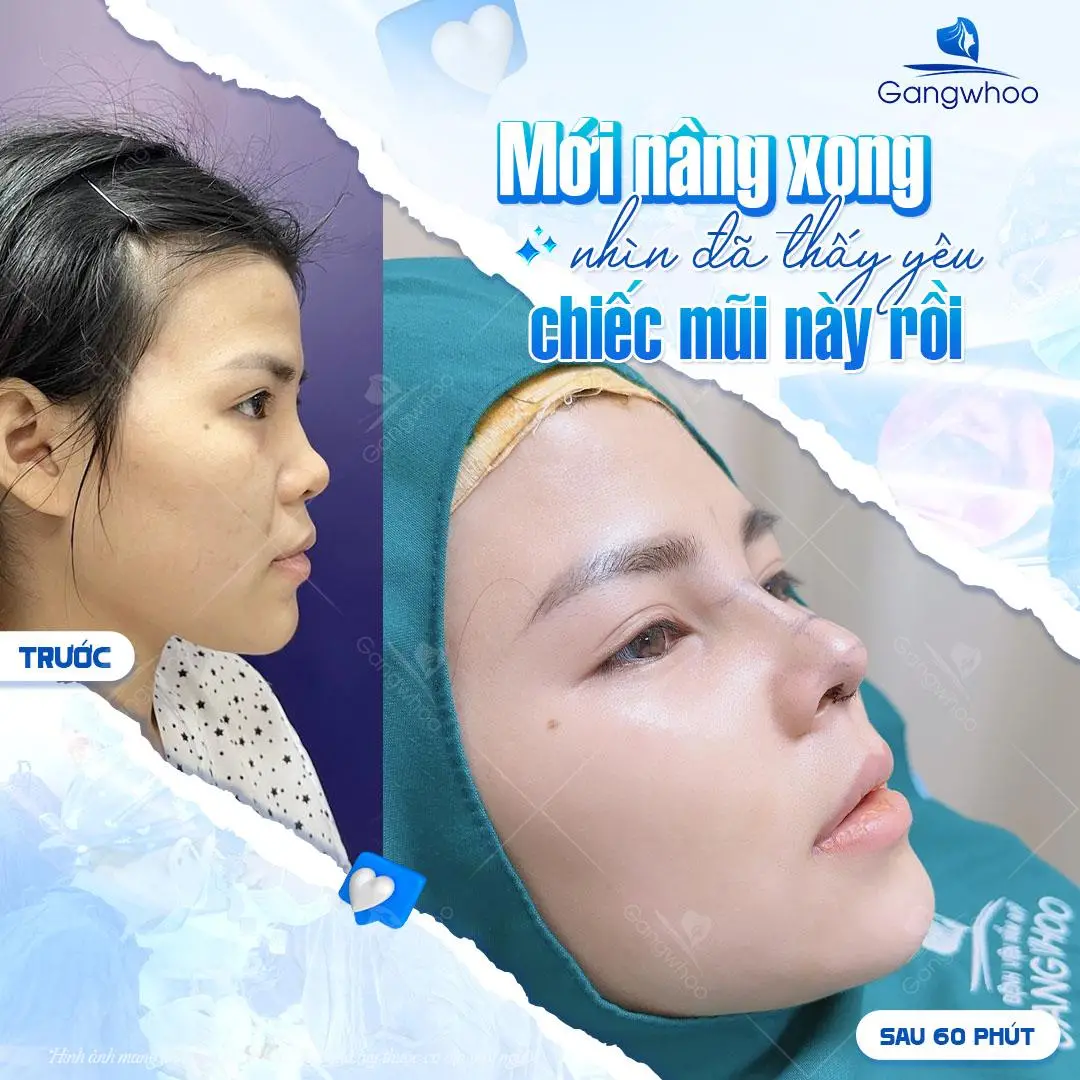 Có nên sử dụng dụng cụ massage nâng mũi không?