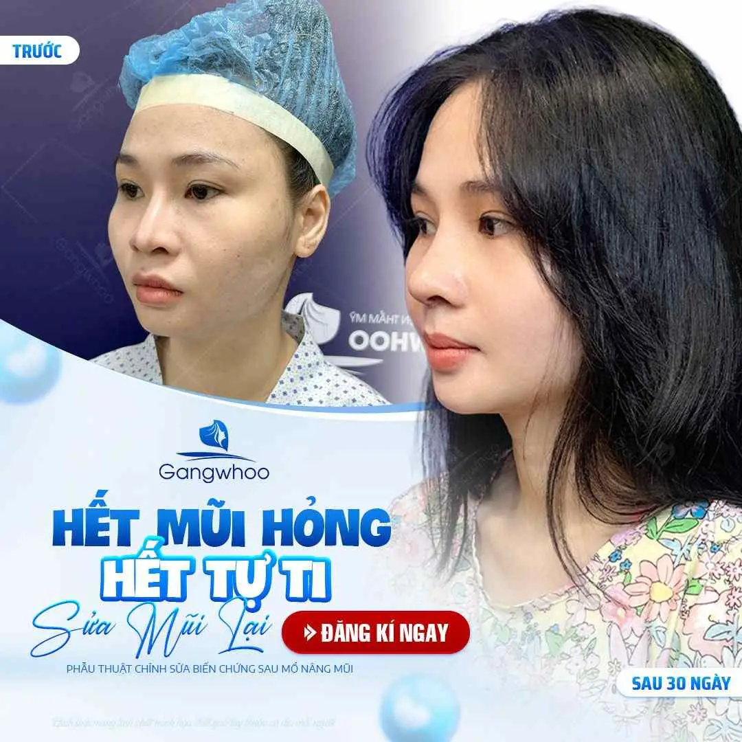 Nguyên nhân xảy ra những rủi ro khi nâng mũi về già