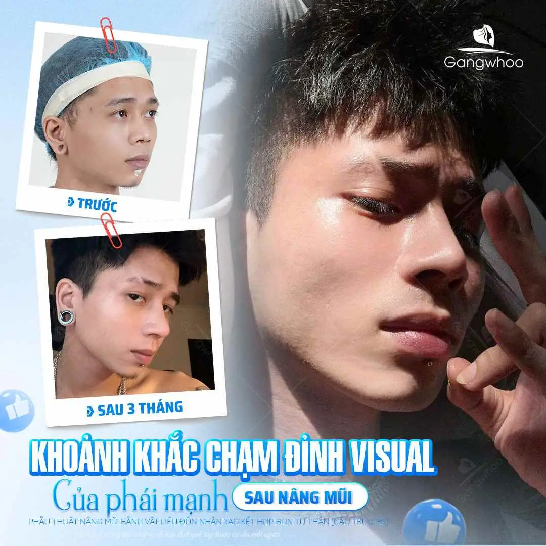 Đặc điểm khuôn mặt hơi dài