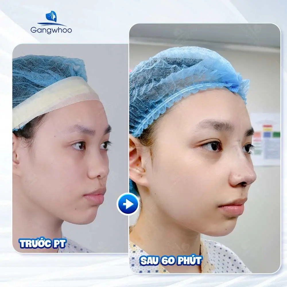Đặc điểm gương mặt tròn