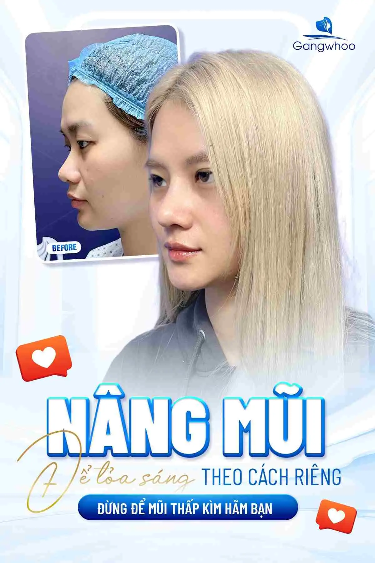 Nguyên tắc chọn dáng mũi cho người mặt tròn