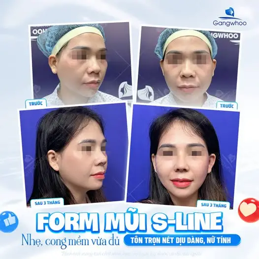 Dáng S-Line chuẩn tỷ lệ Á Đông