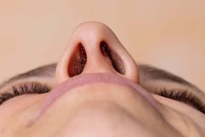 Dấu hiệu nhận biết mũi bị lung lay sau nâng mũi