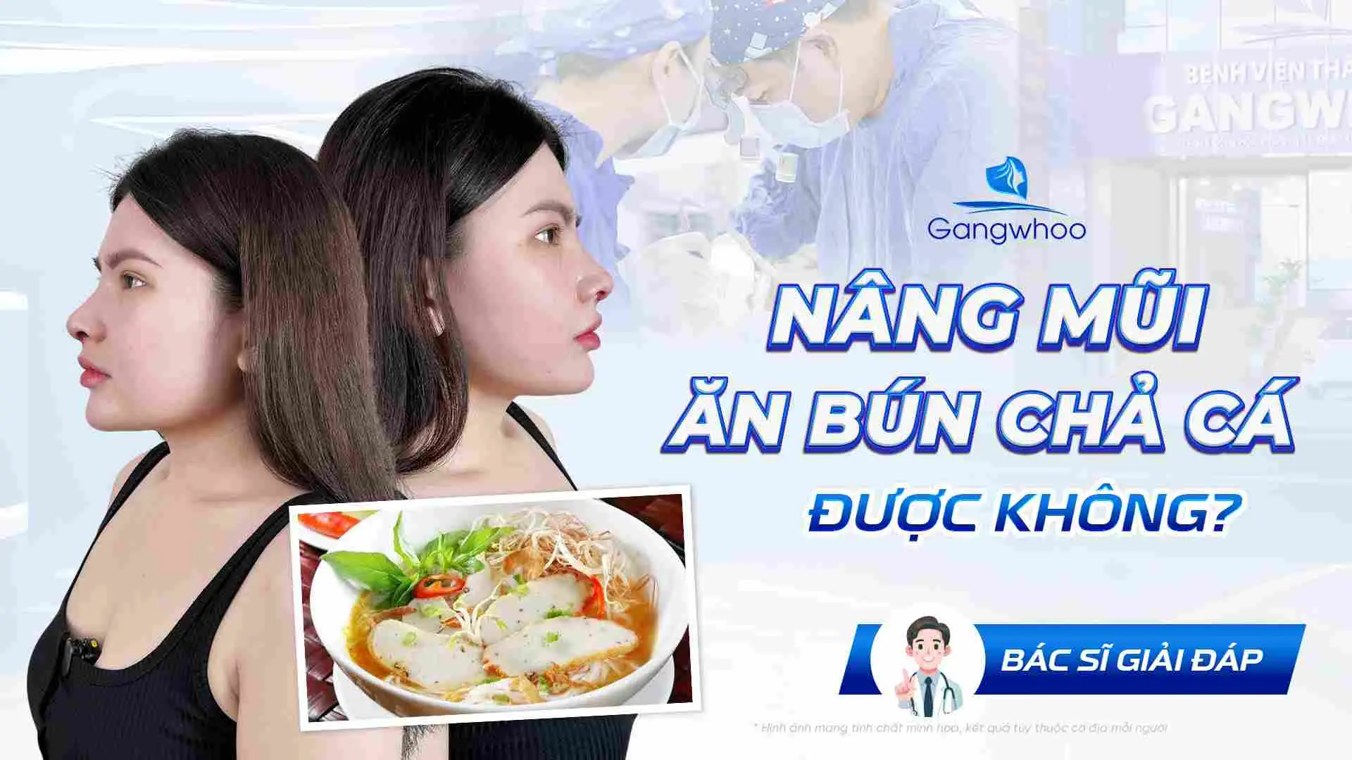 Nâng Mũi Ăn Bún Chả Cá Được Không? Bác Sĩ Giải Đáp