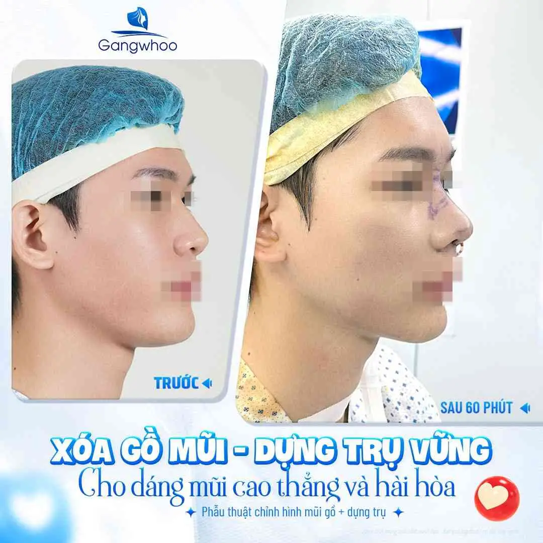 Những rũi ro về biến chứng có thể gặp nếu ăn chả cá quá sớm