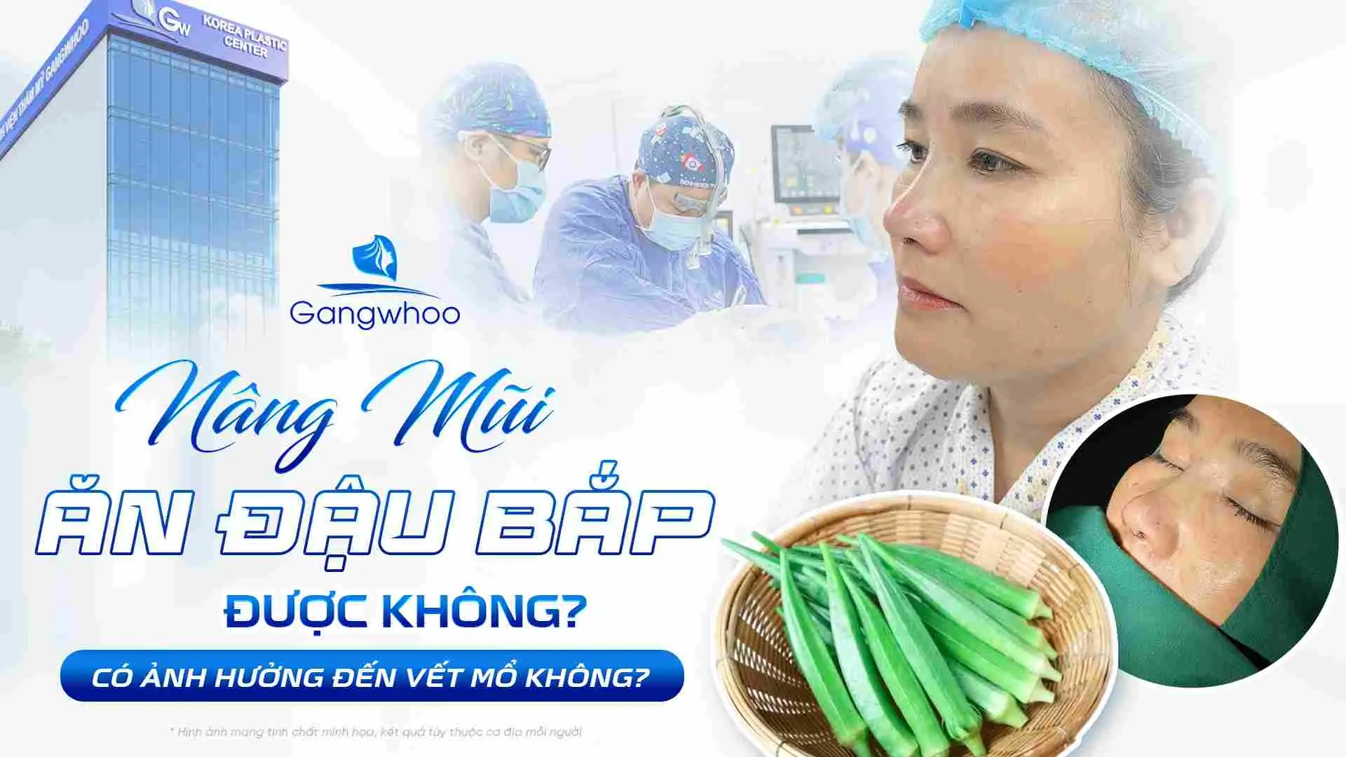 Nâng Mũi Ăn Đậu Bắp Được Không? Có Ảnh Hưởng Đến Vết Mổ Không?