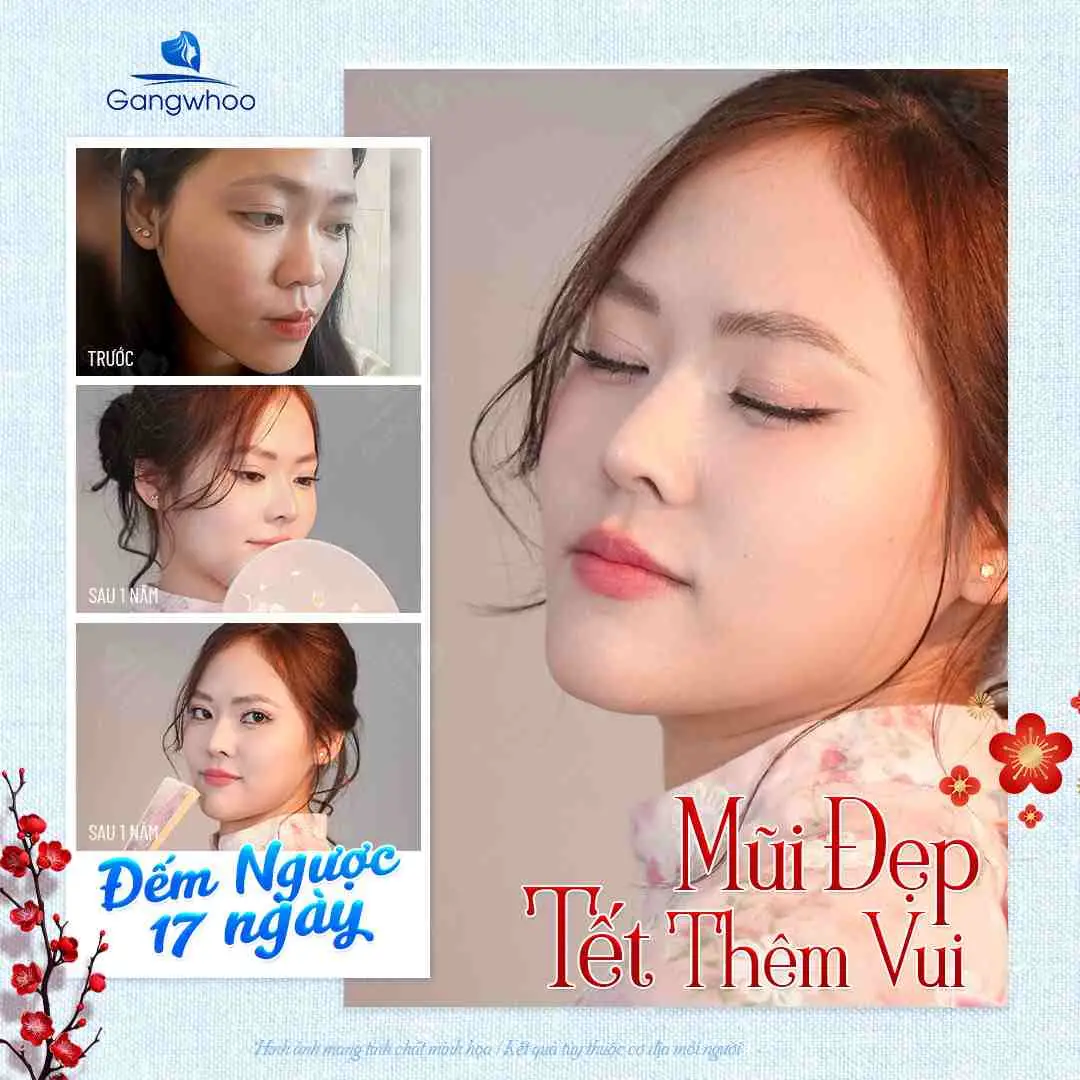 Lưu ý khi ăn đậu bắp trong thời gian hồi phục