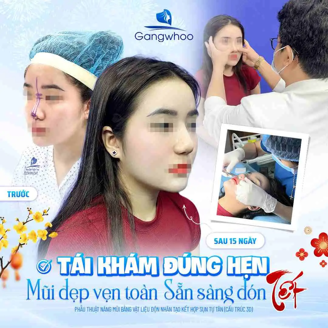 Nâng mũi tại BVTM Gangwhoo bạn sẽ được thăm khám cũng như tư vấn cách chăm sóc tận tình
