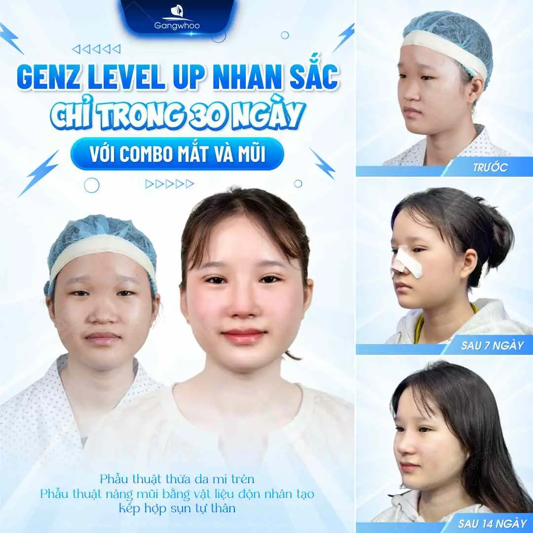 Trường hợp nên và không nên ăn dứa sau nâng mũi
