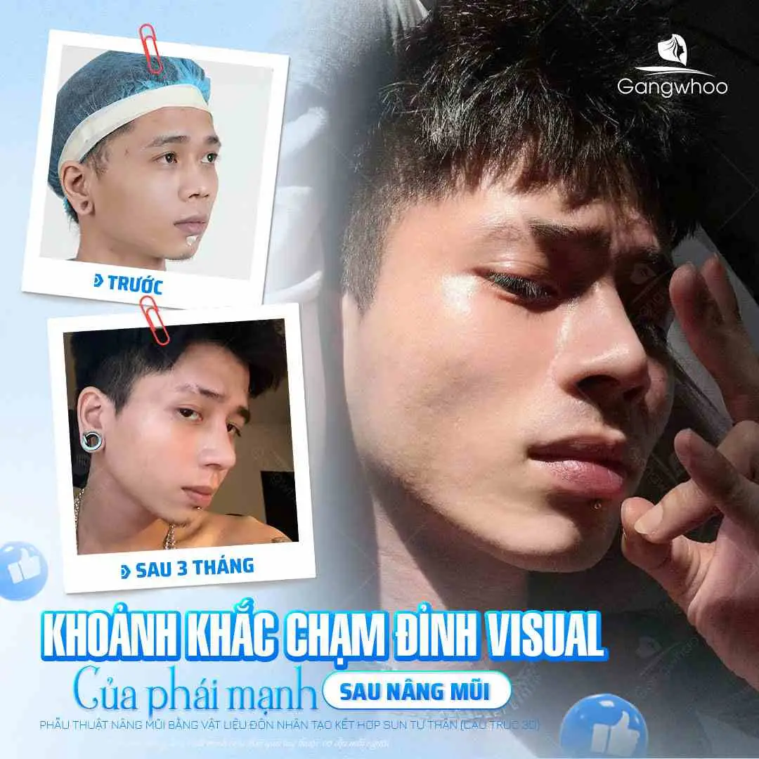 Trường hợp nào nên kiêng hột vịt lộn lâu hơn?