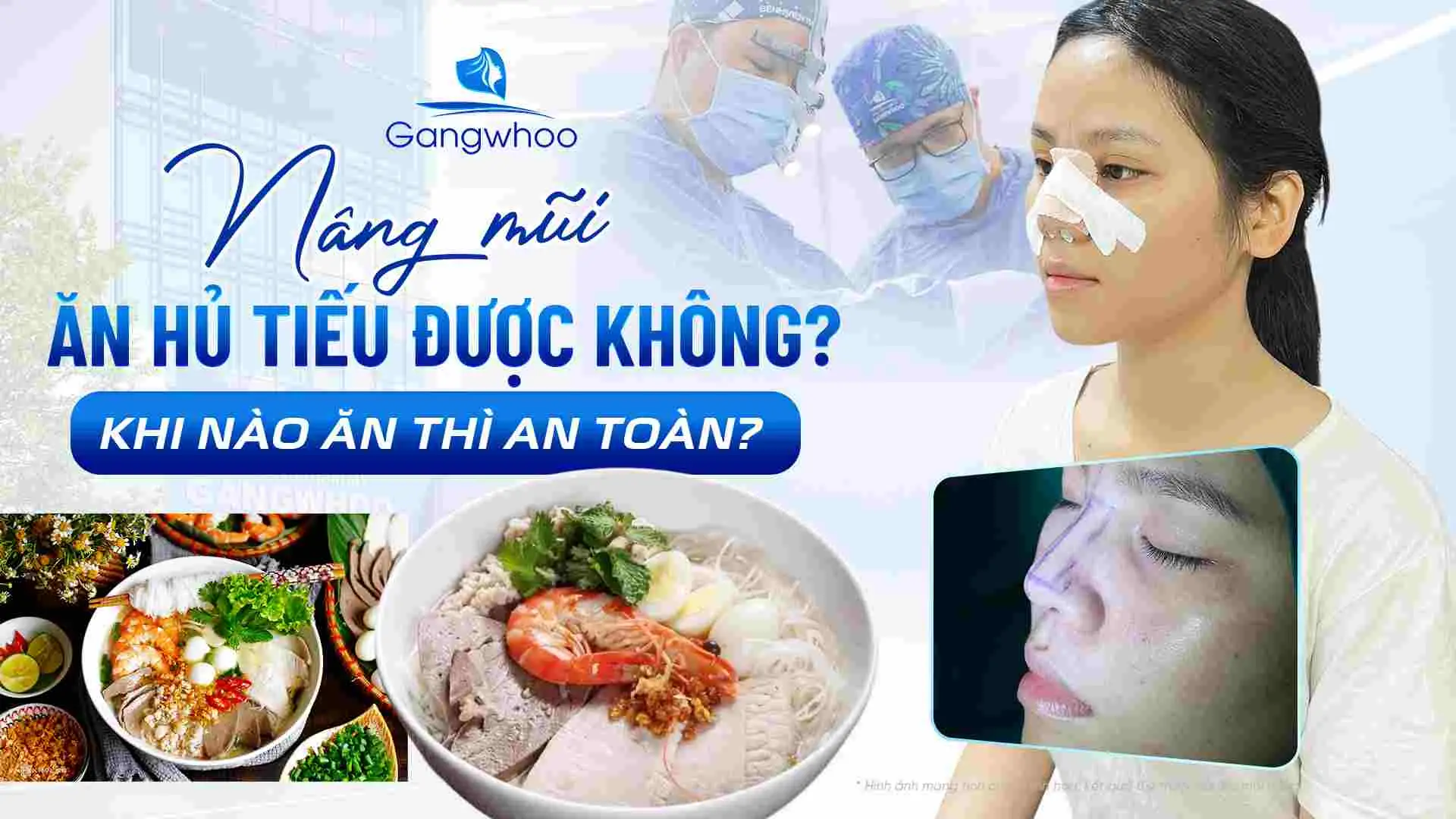 Nâng Mũi Ăn Hủ Tiếu Được Không? Khi Nào Ăn Thì An Toàn?