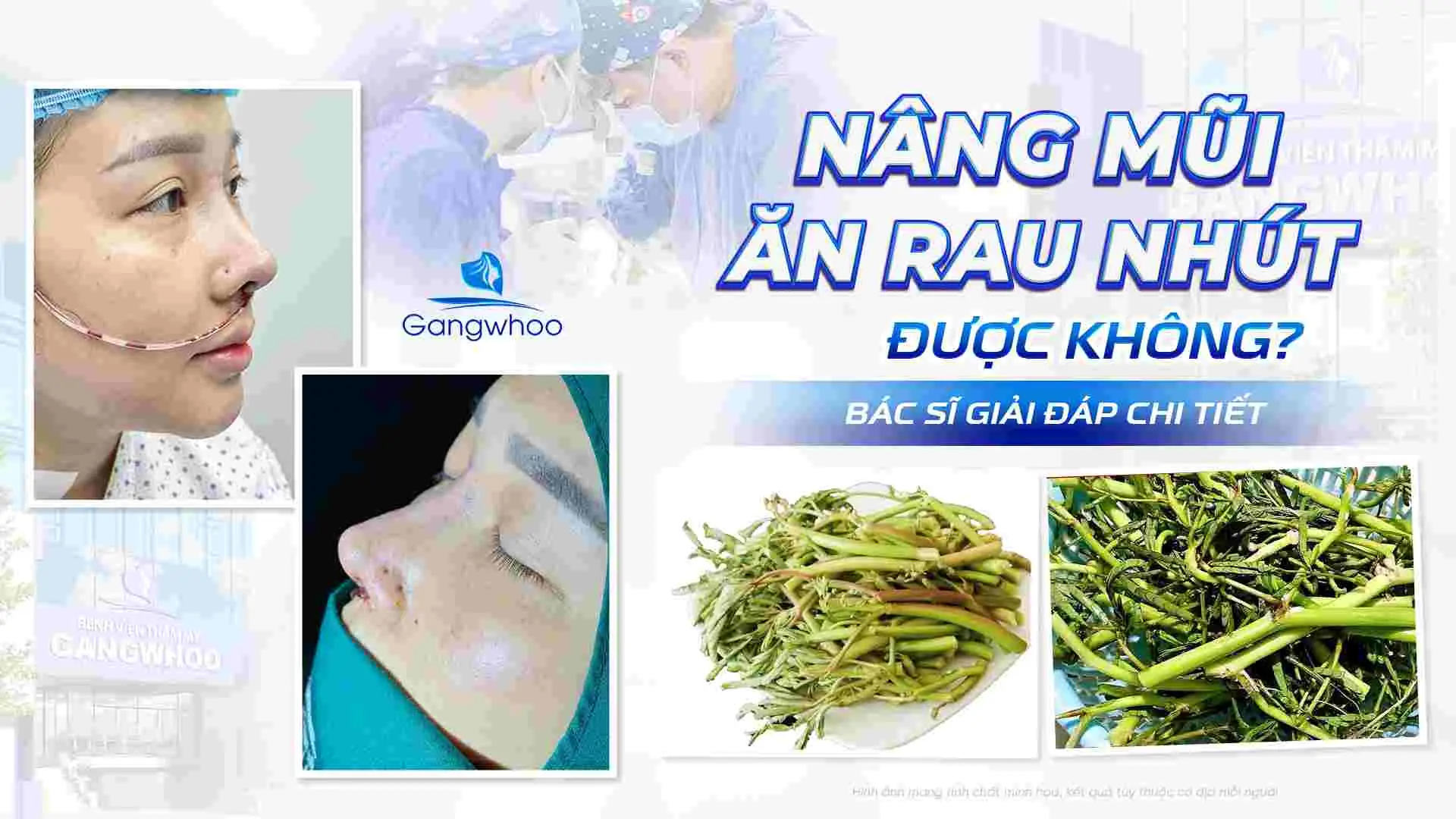 Nâng Mũi Ăn Rau Nhút Được Không? Bác Sĩ Giải Đáp Chi Tiết