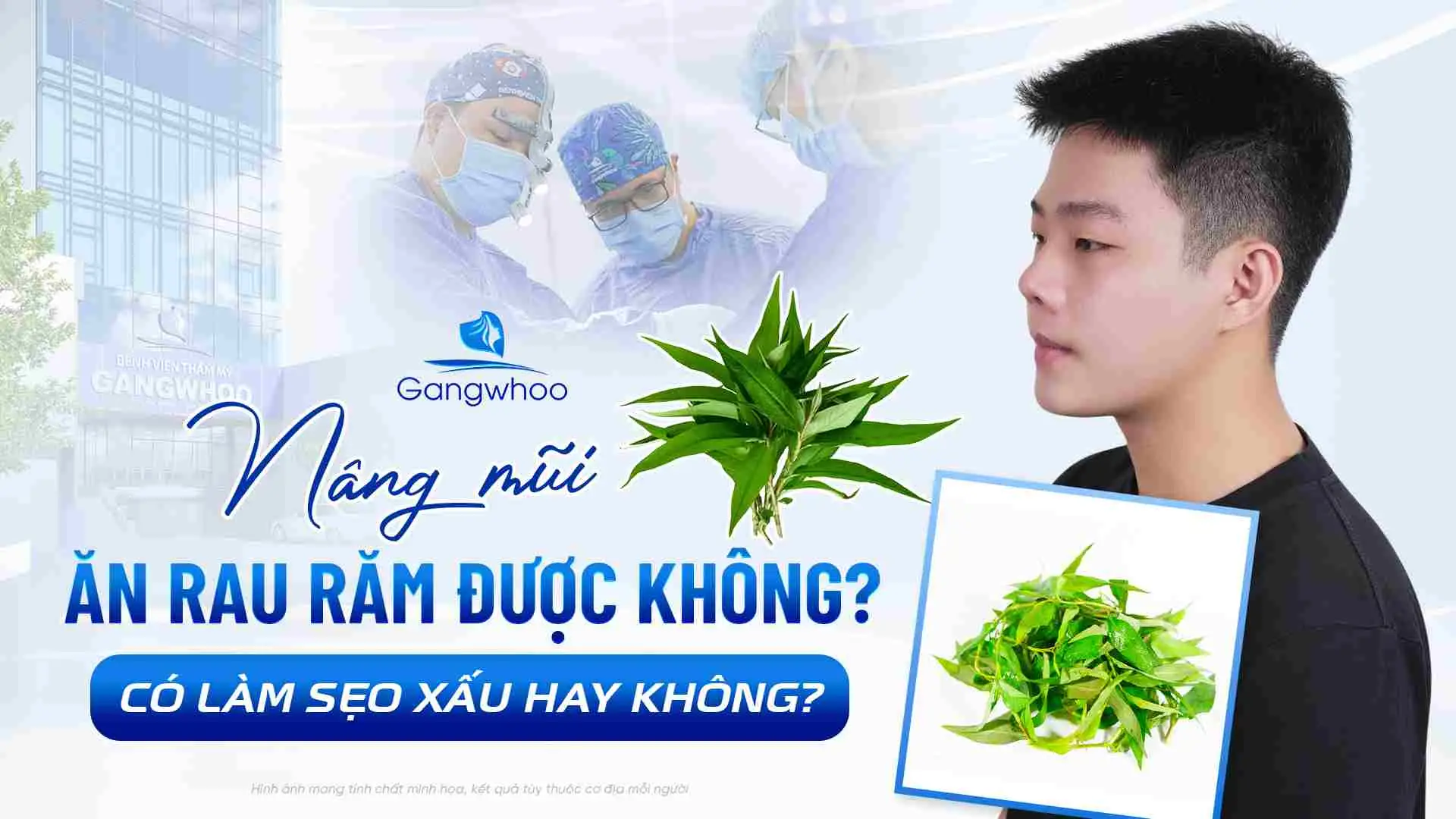 Nâng Mũi Ăn Rau Răm Được Không? Có Làm Sẹo Xấu Hay Không?