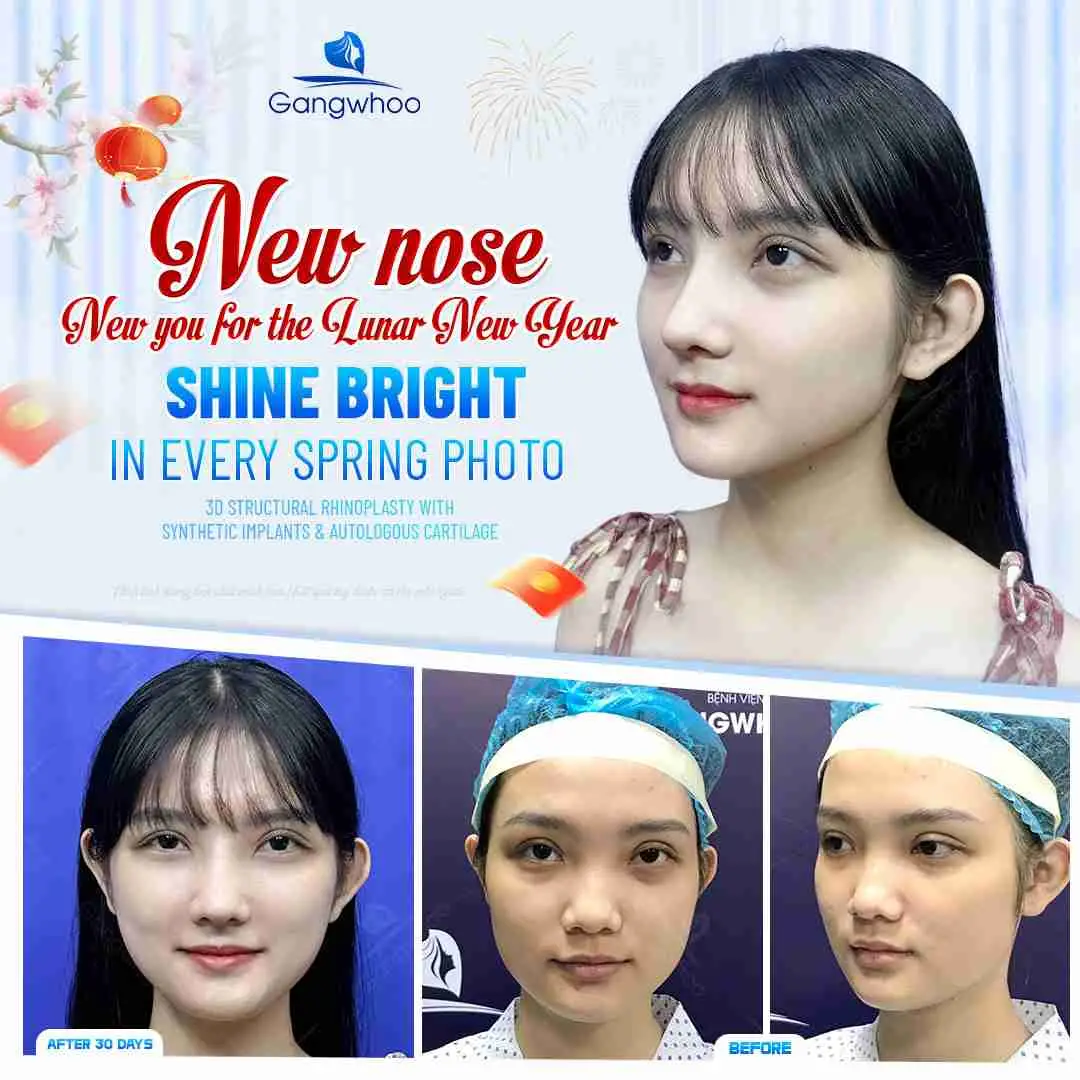 Những đặc tính của rau răm đối với những người sau phẫu thuật