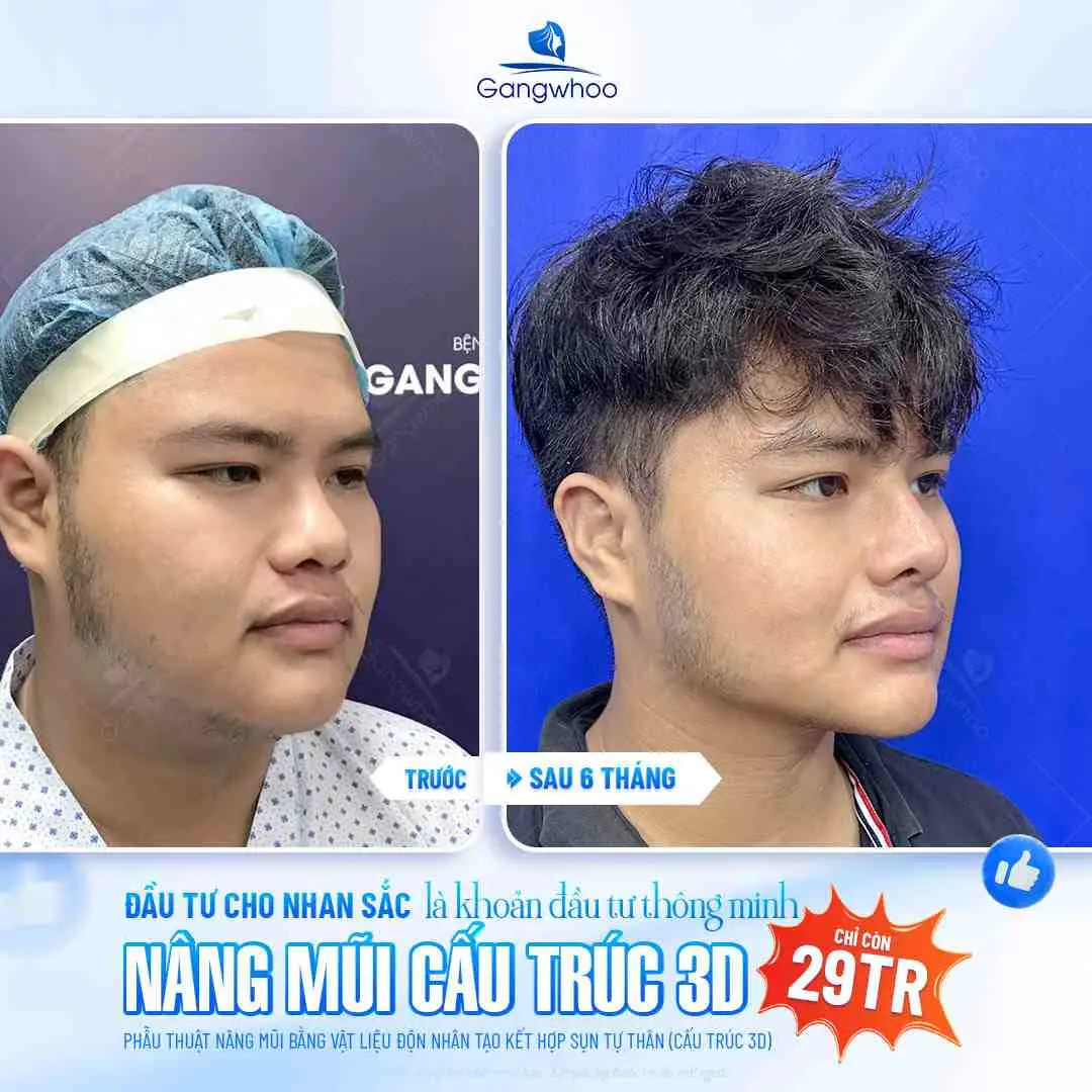 Nâng mũi ăn thịt thỏ được không?