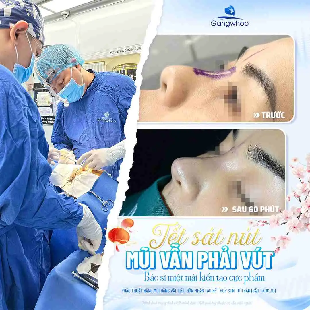 Những ảnh hưởng khi ăn thịt thỏ sau nâng mũi