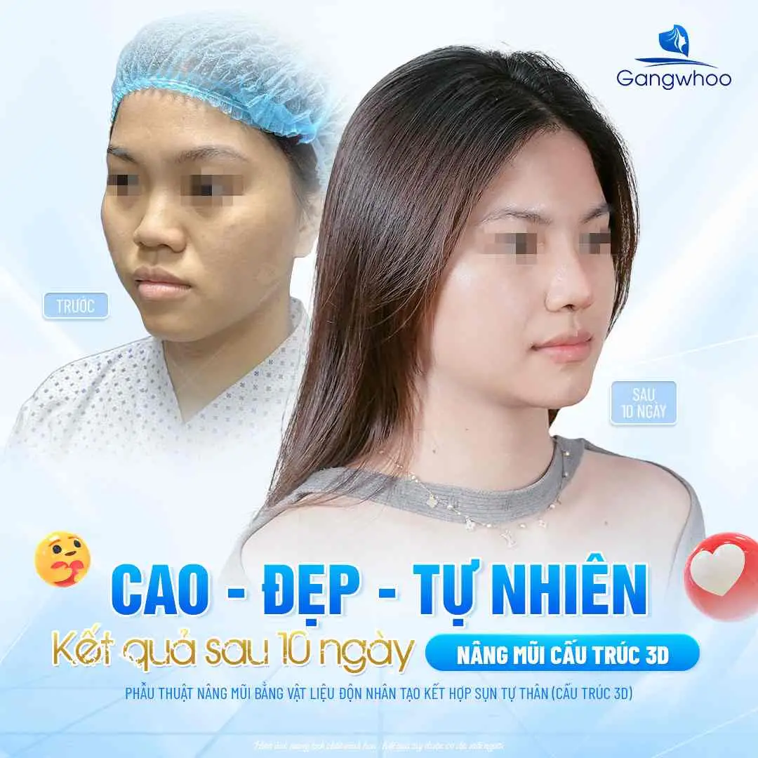 Mẹo kết hợp trứng trong bữa ăn hồi phục