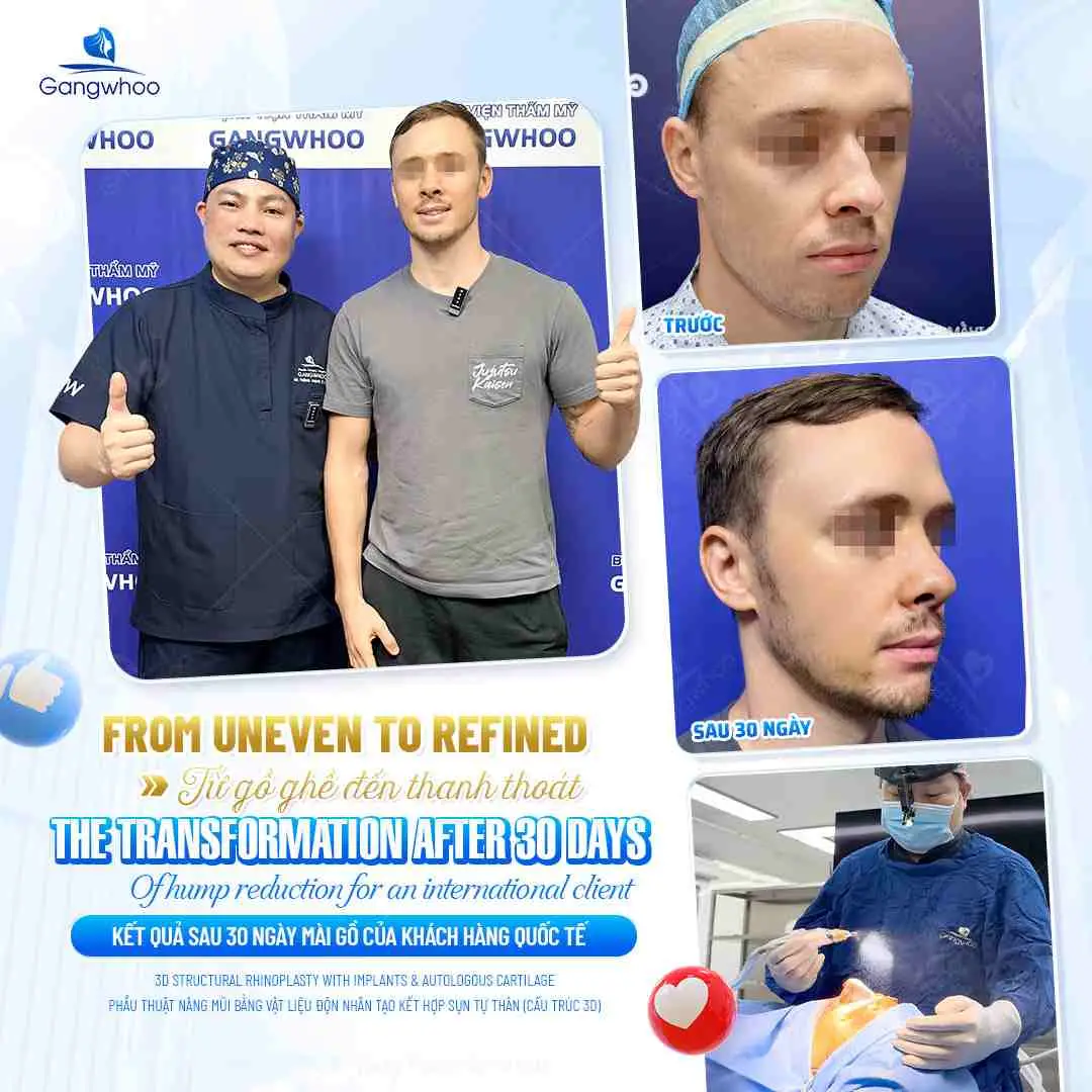 Ảnh hưởng lâu dài nếu hút thuốc quá sớm