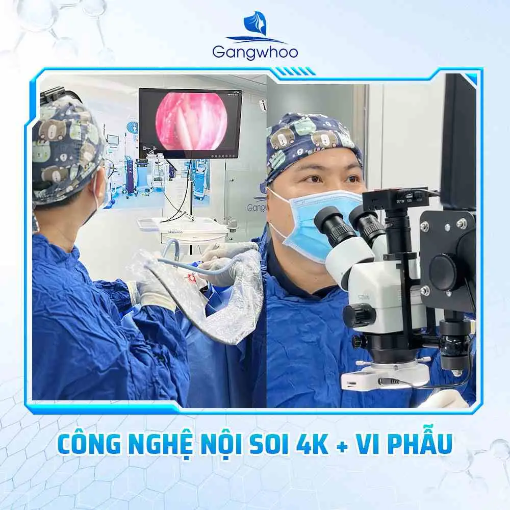 Nâng mũi tại Gangwhoo với hệ thống nội soi 4K tân tiến nhất