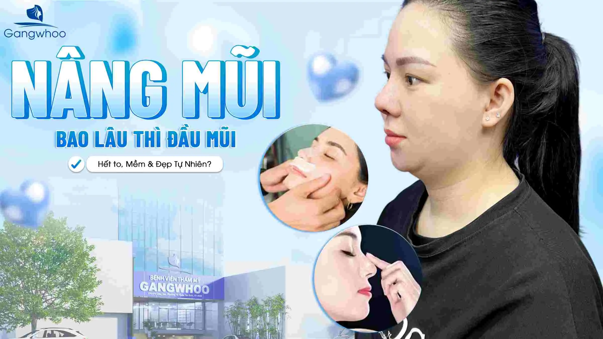Nâng Mũi Bao Lâu Thì Đầu Mũi Hết To, Mềm & Đẹp Tự Nhiên?