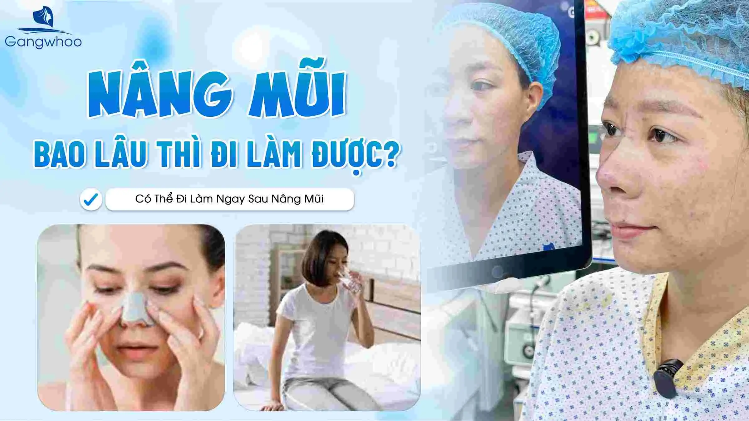 Nâng Mũi Bao Lâu Thì Đi Làm Được? Có Thể Đi Làm Ngay Sau Nâng Mũi