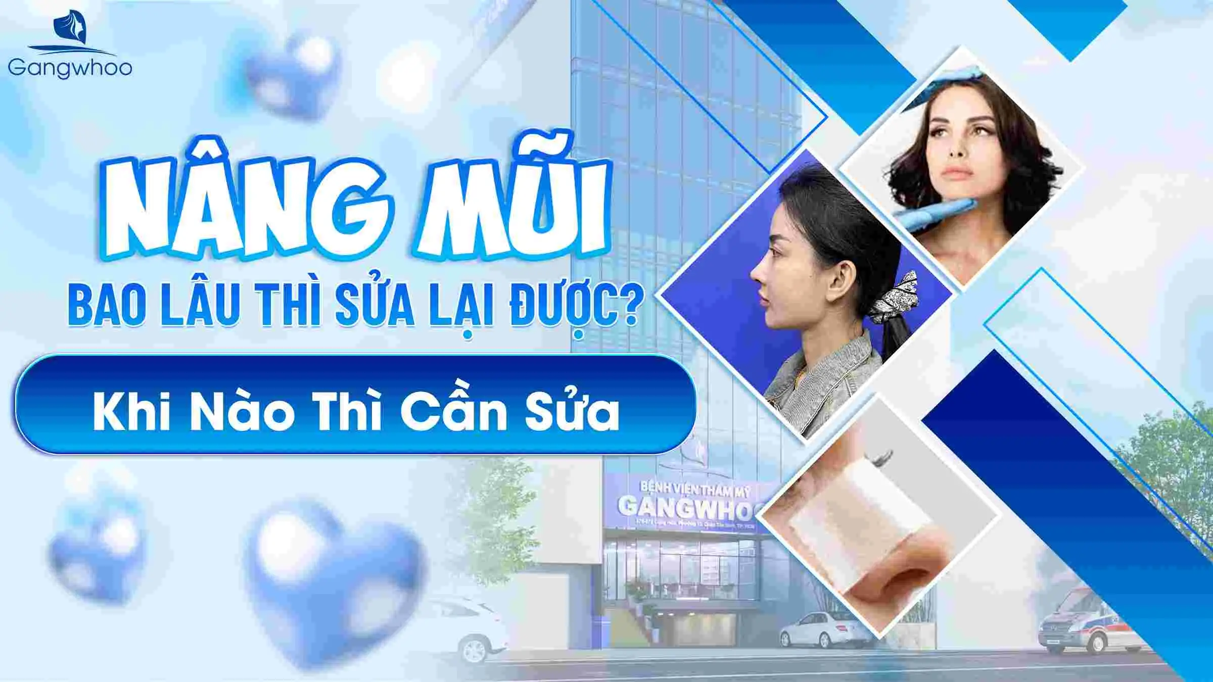 Nâng Mũi Bao Lâu Thì Sửa Lại Được? Khi Nào Thì Cần Sửa
