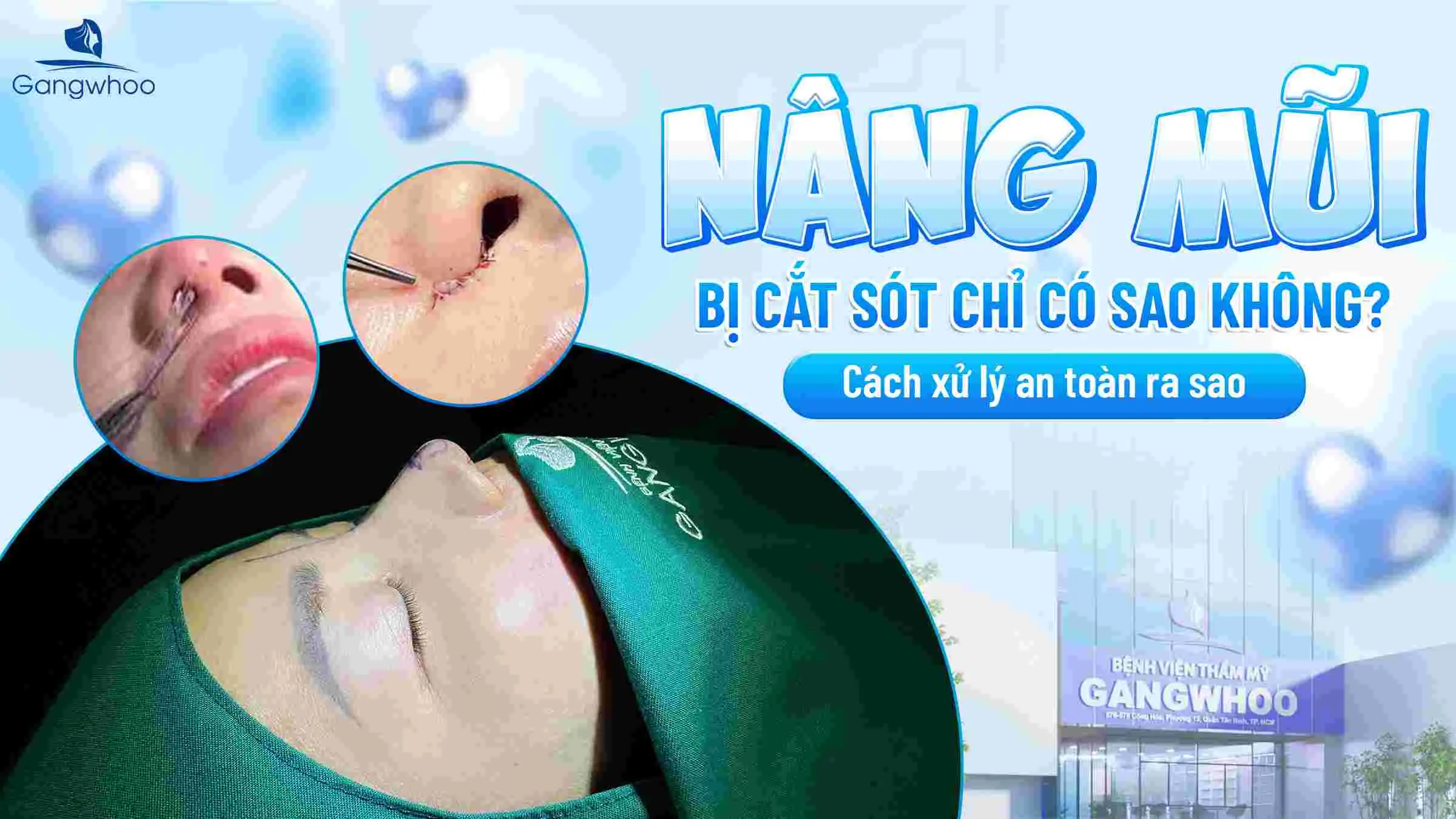 Nâng Mũi Bị Cắt Sót Chỉ Có Sao Không? Cách Xử Lý An Toàn Ra Sao