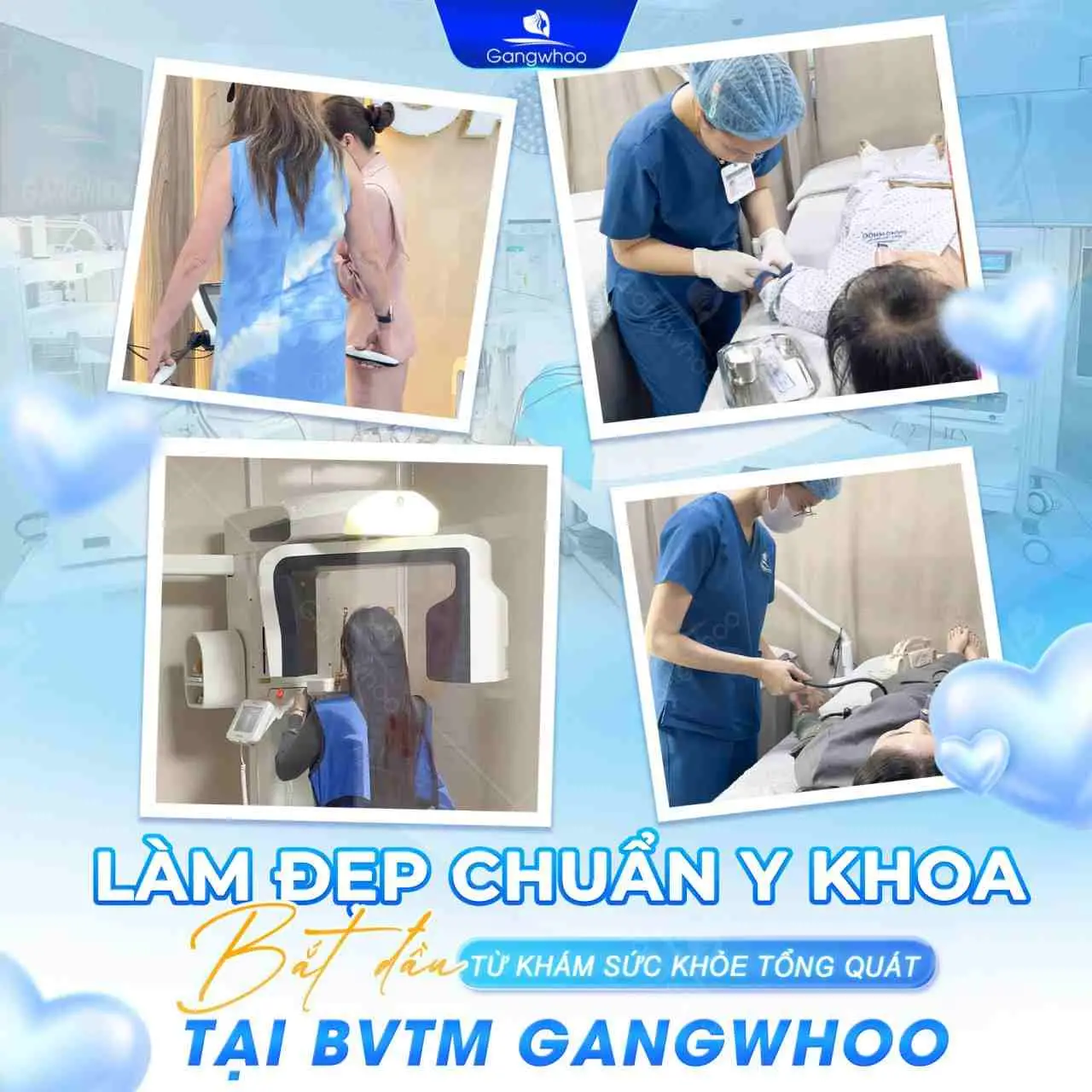 Nâng mũi tại Gangwhoo với đầy đủ quy trình các bước