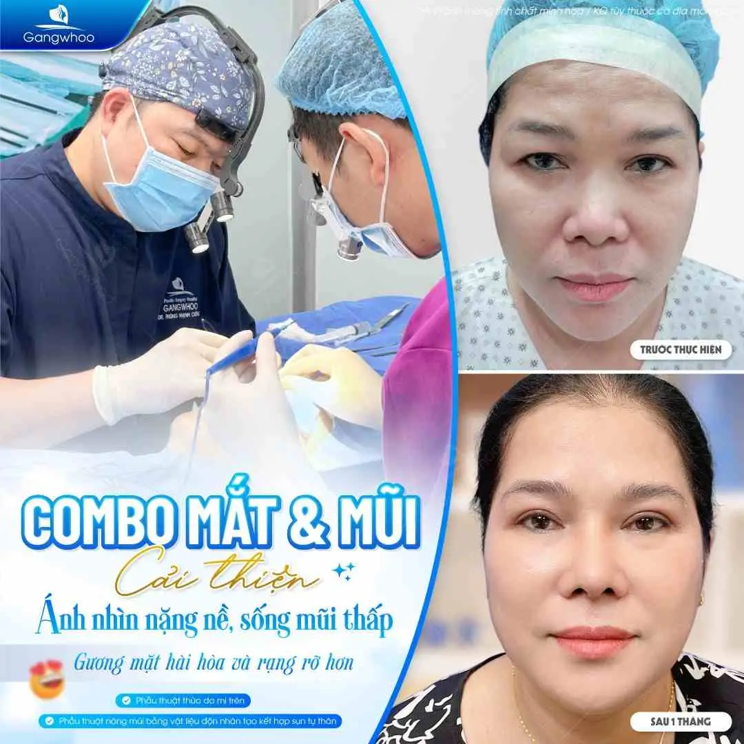 Tại Gangwhoo các bác sĩ có chuyên môn cao sẽ tránh được những biến chứng khi nâng mũi