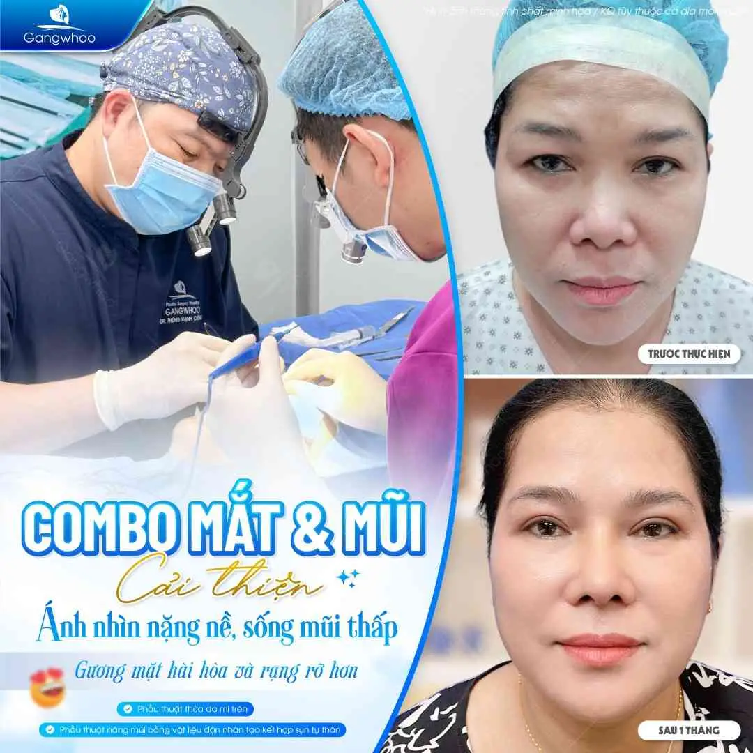 Tay nghề bác sĩ tại Gangwhoo với nhiều năm kinh nghiệm sẽ hạn chế tối đa biến chứng