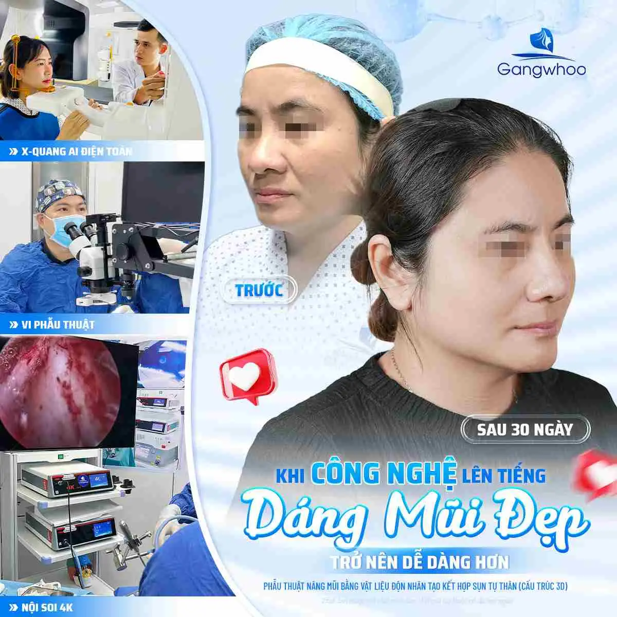 Cách xử lý khi vết thương bị hở