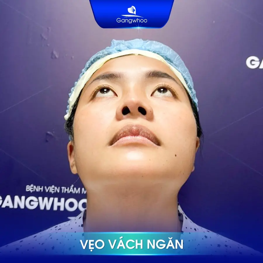 Tình trạng mũi bị lệch vách ngăn