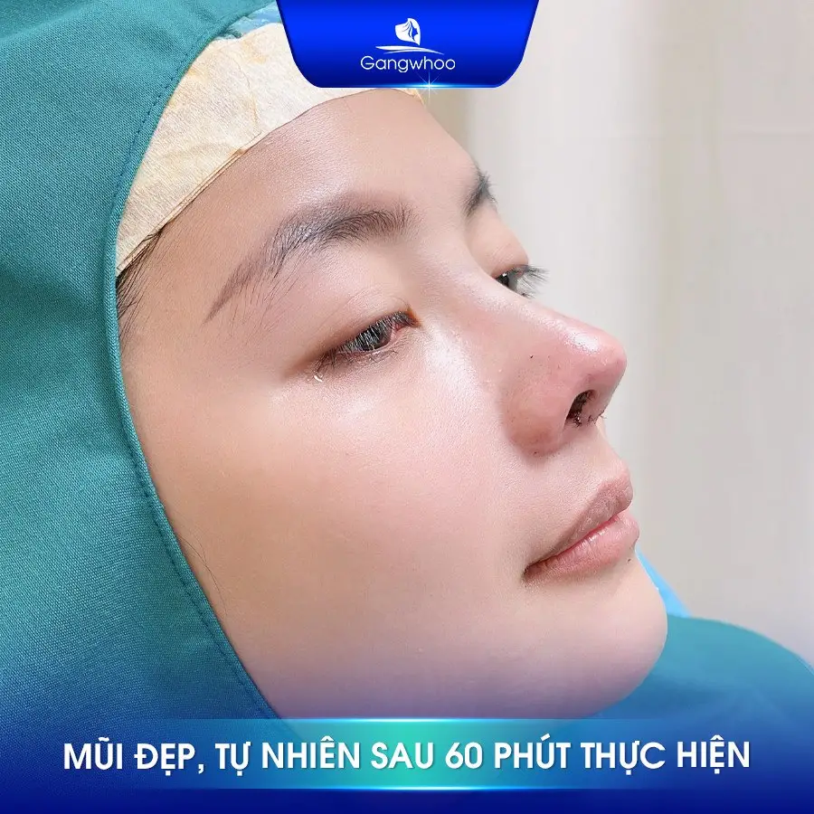 Tình trạng lệch vách ngăn có thể xử lý hoặc tránh tình trạng trên bằng công nghệ nâng mũi hiện đại tại Gangwhoo