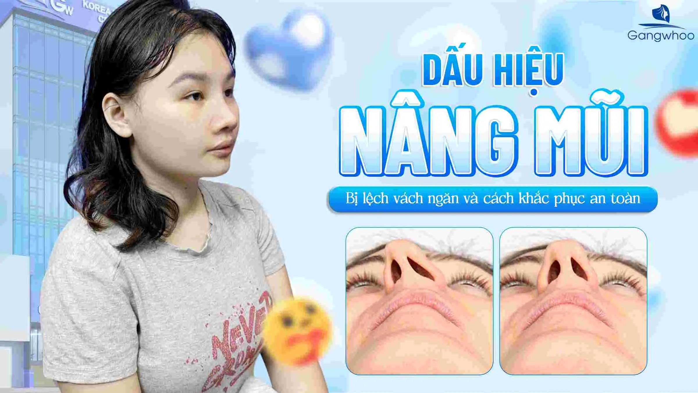 Dấu Hiệu Nâng Mũi Bị Lệch Vách Ngăn Và Cách Khắc Phục An Toàn