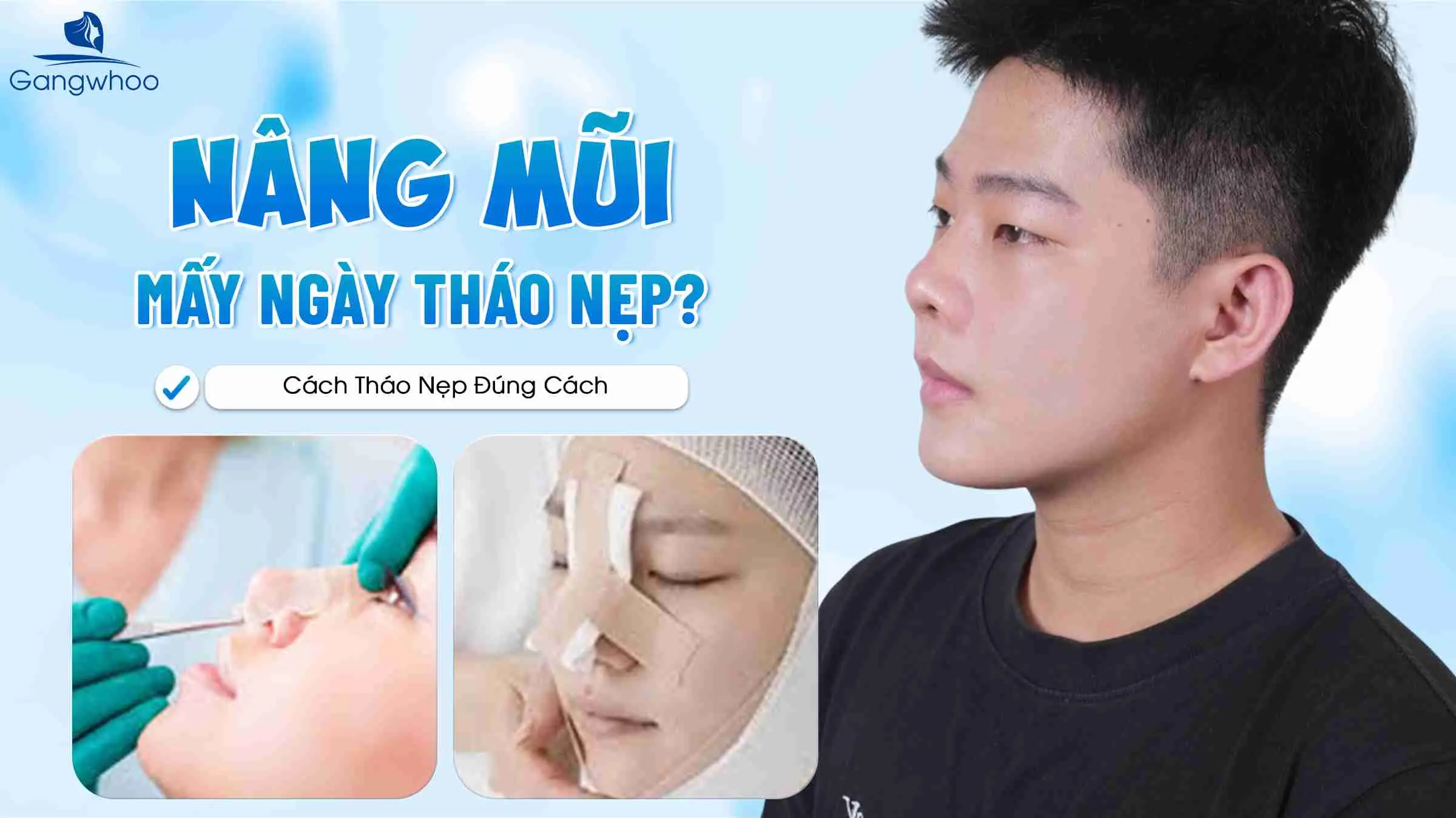 Nâng Mũi Mấy Ngày Tháo Nẹp? Cách Tháo Nẹp Đúng Cách