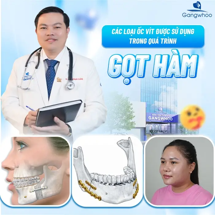 Các loại ốc vít được sử dụng trong quá trình gọt hàm