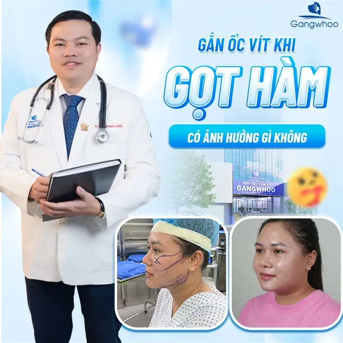Gắn ốc vít khi gọt hàm có ảnh hưởng gì không