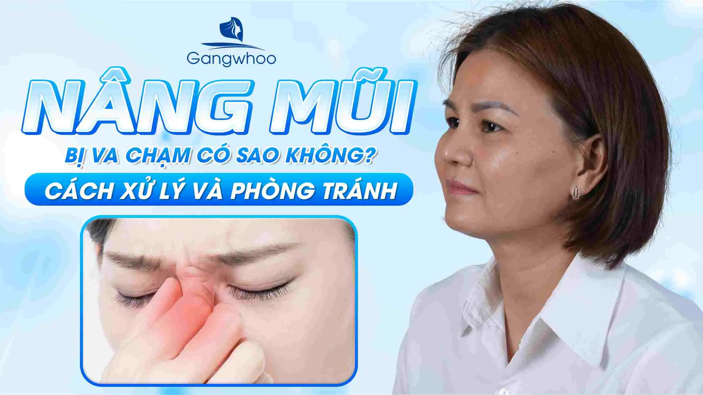 Nâng Mũi Bị Va Chạm Có Sao Không? Cách Xử Lý Và Phòng Tránh