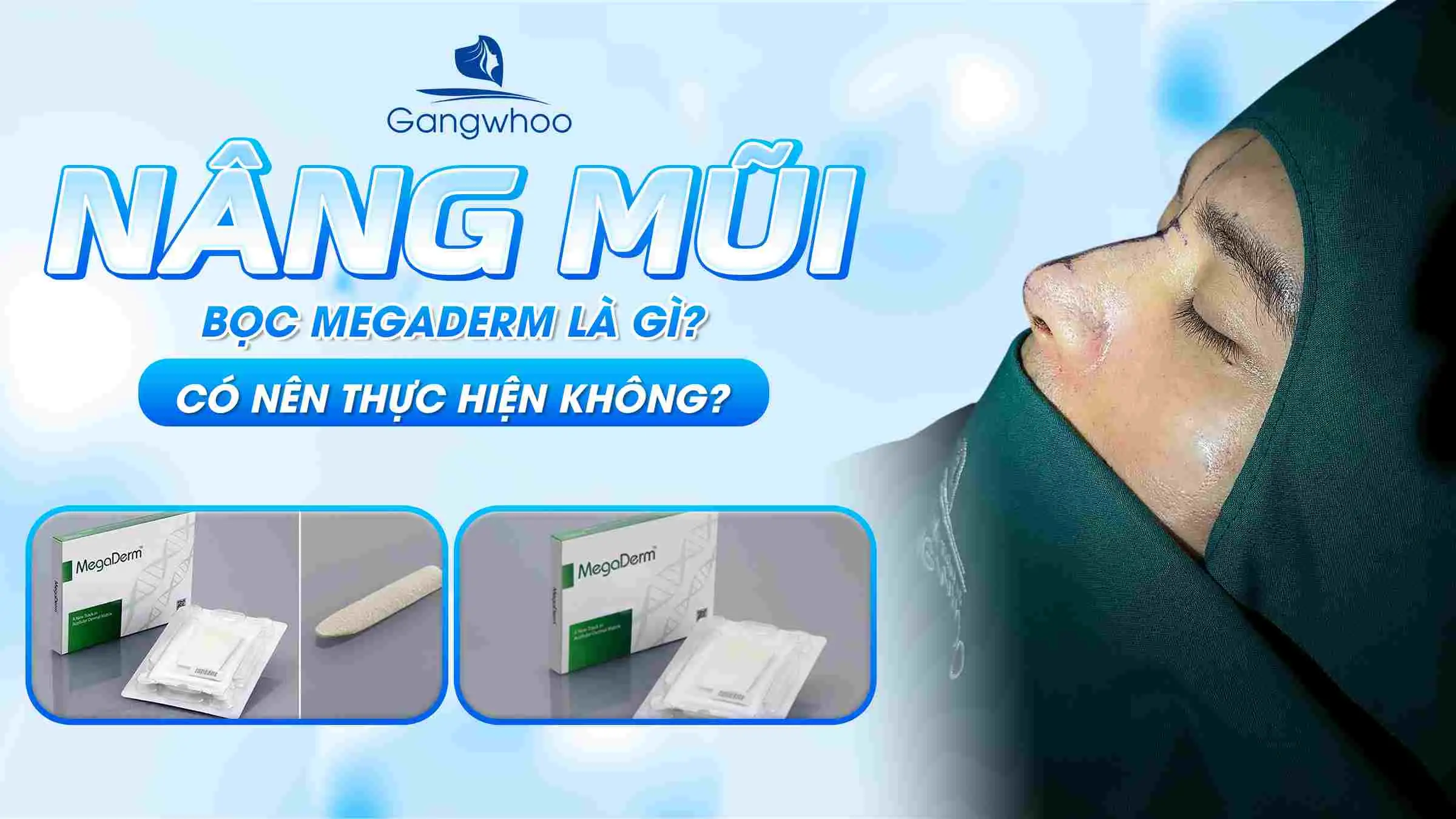 Nâng Mũi Bọc Megaderm Là Gì? Có Nên Thực Hiện Không?